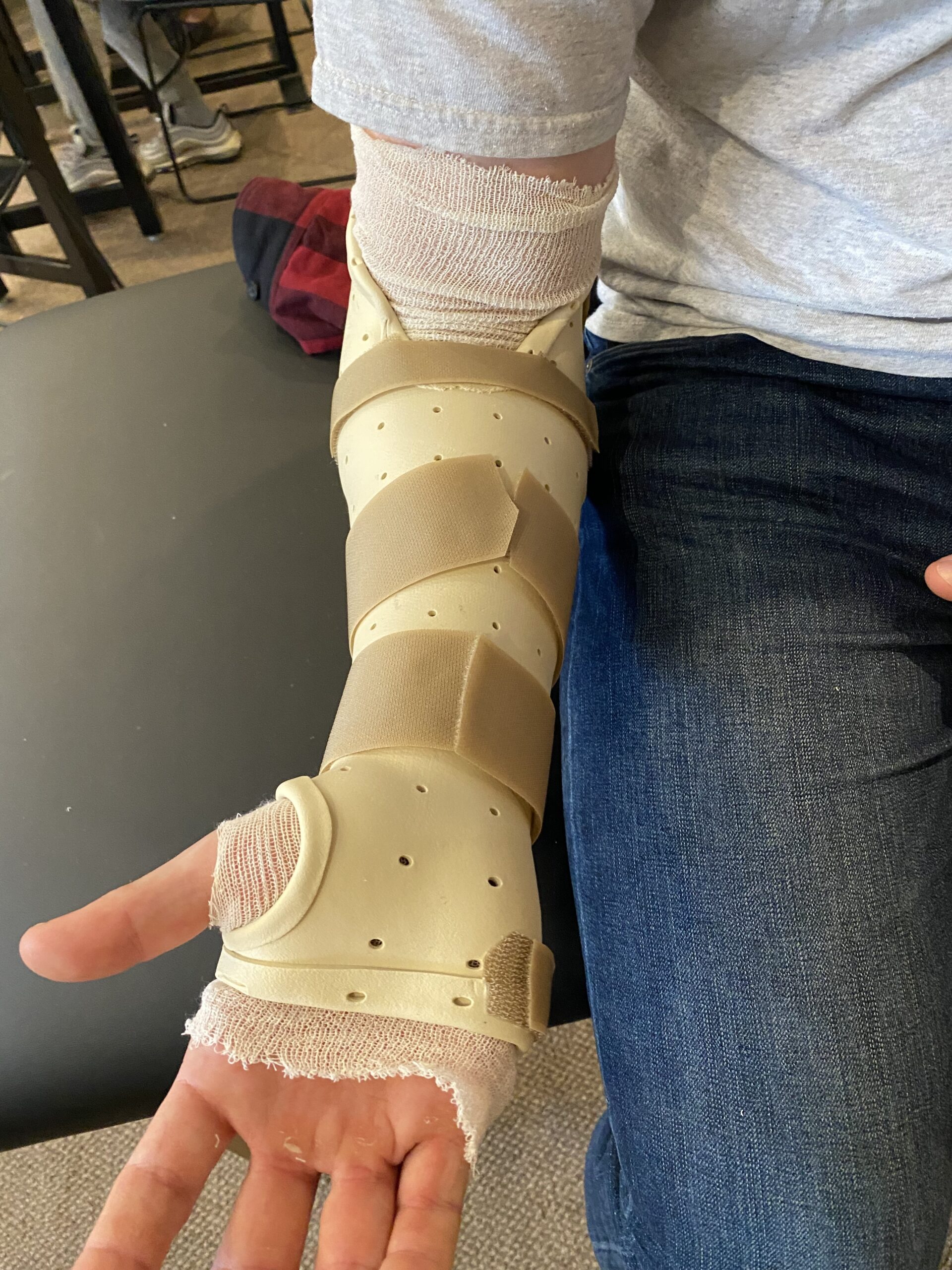 Hand Splint